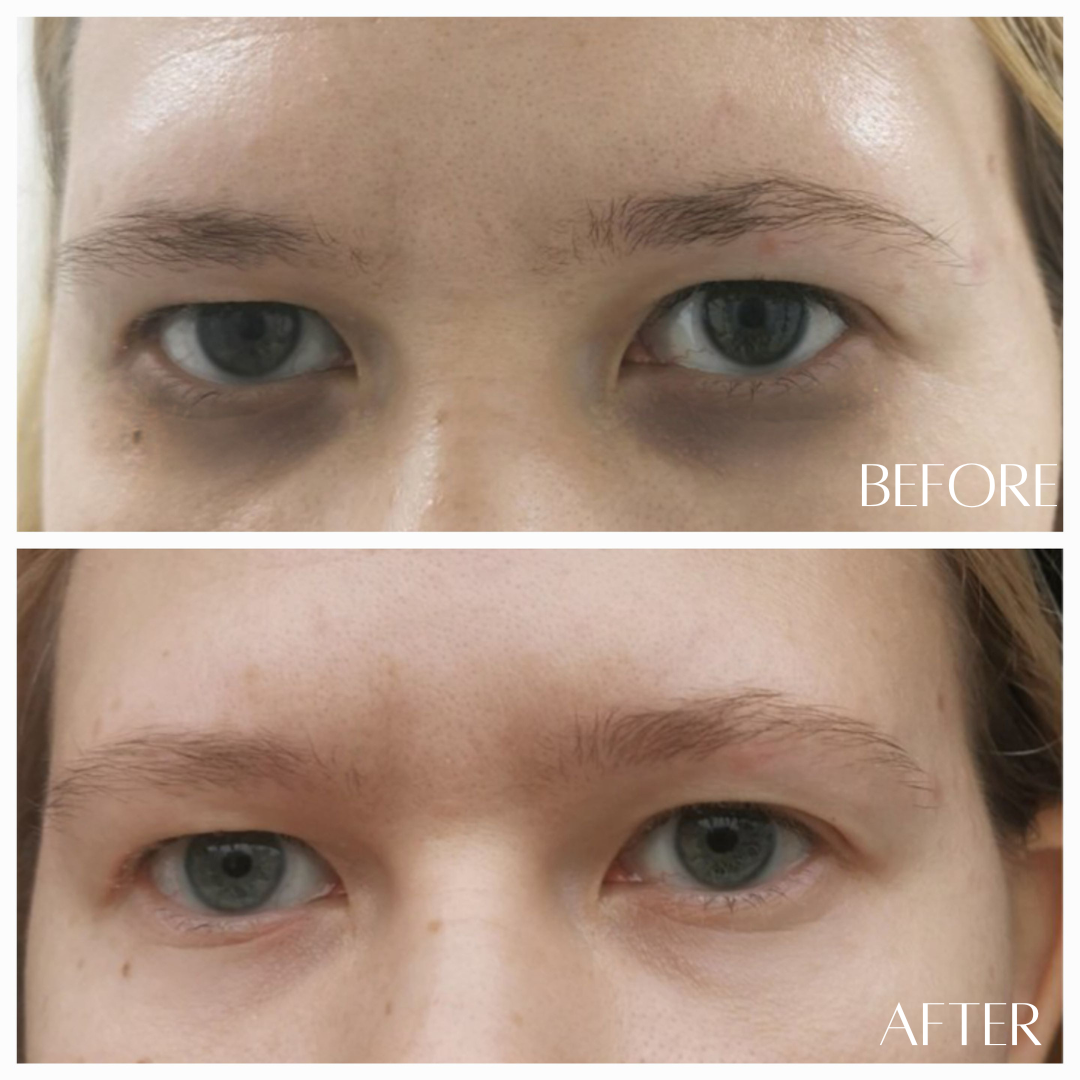 REAWAKEN - 24k Gold Illuminating Eye Elixir