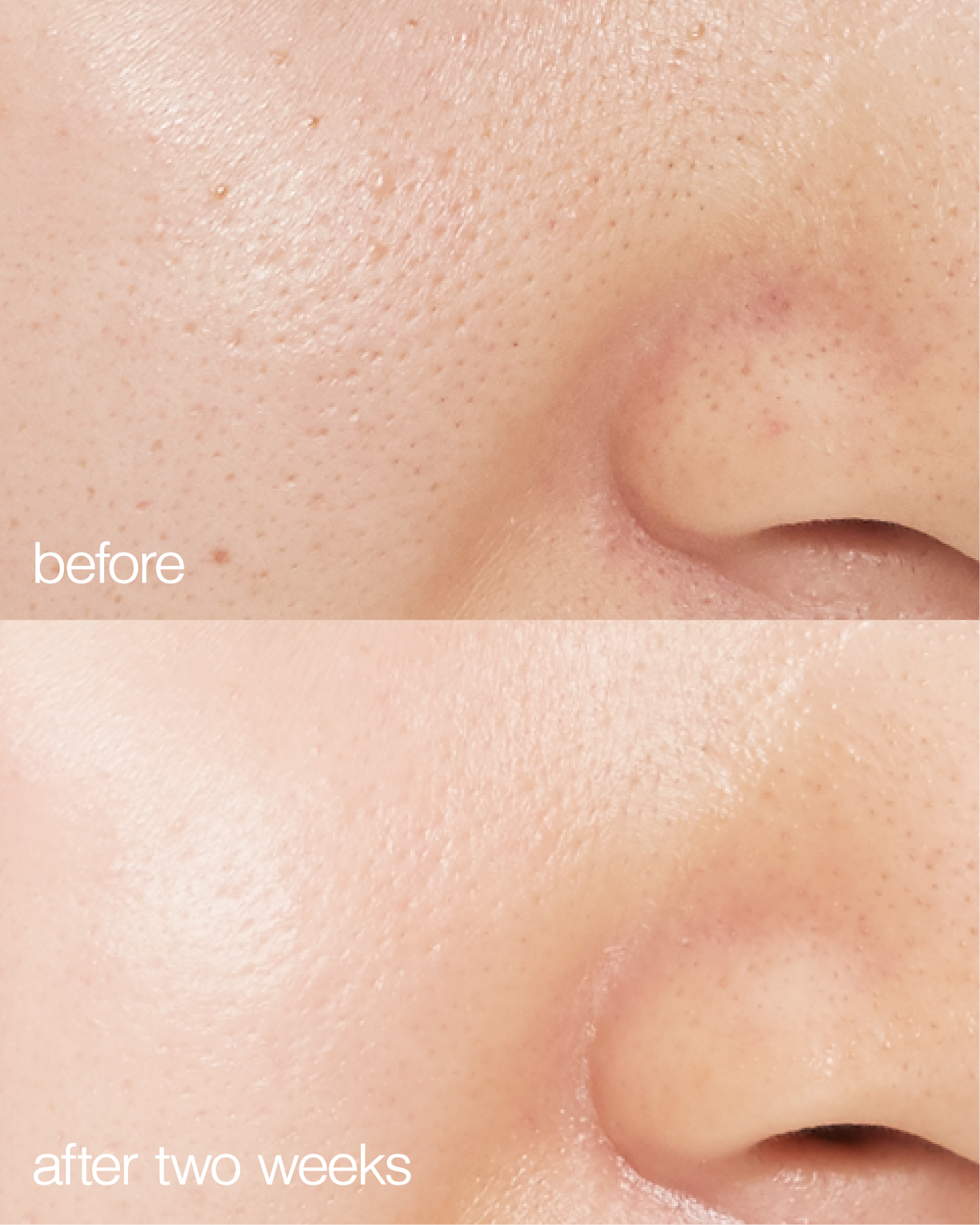 biome boost cream daily moisturizer before and after pictures. Pores have been visibly reduced and redness gone.