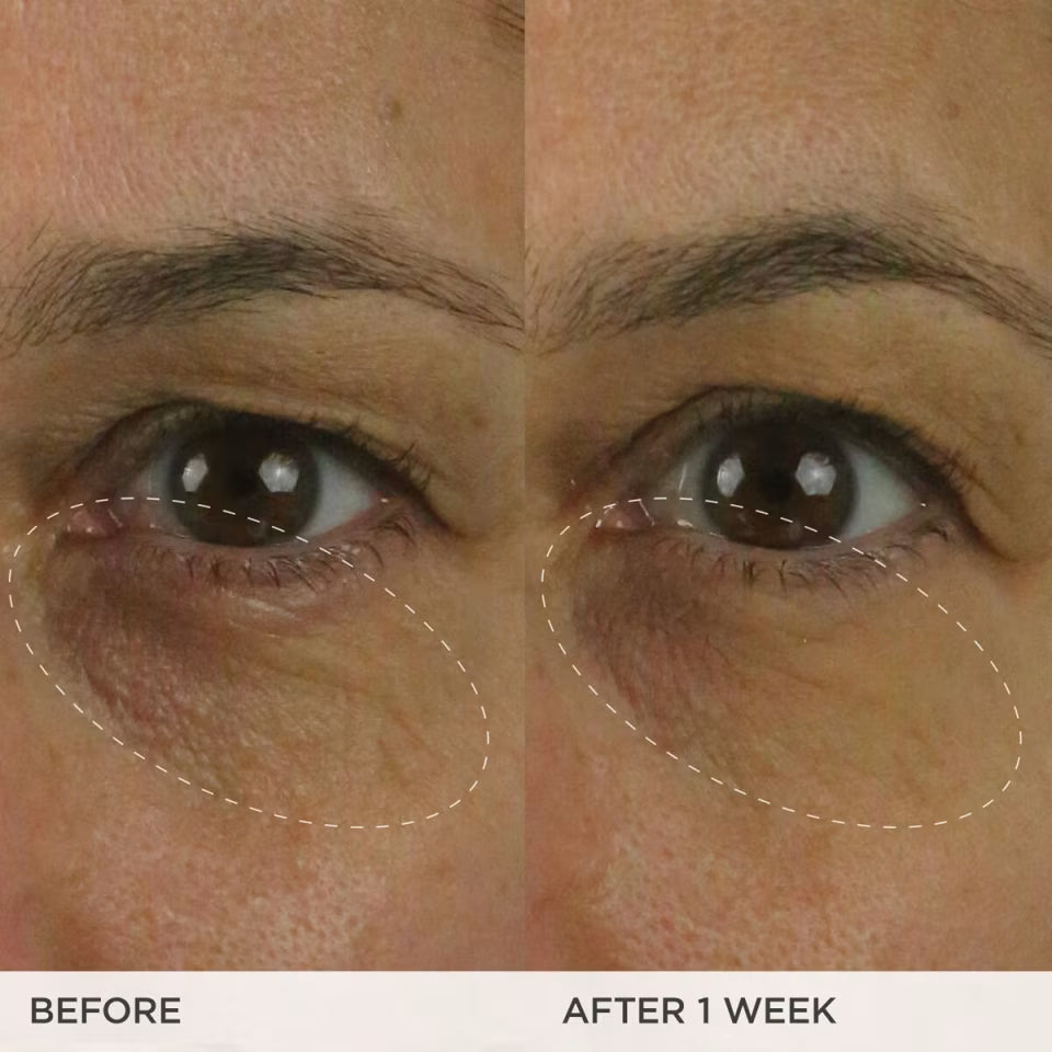 TATCHA The Brightening Eye Cream | Brightening & Dark Circle Reduction with Vitamin C for Bight, Firm Undereyes, 15 ml / 0.5 fl. oz.