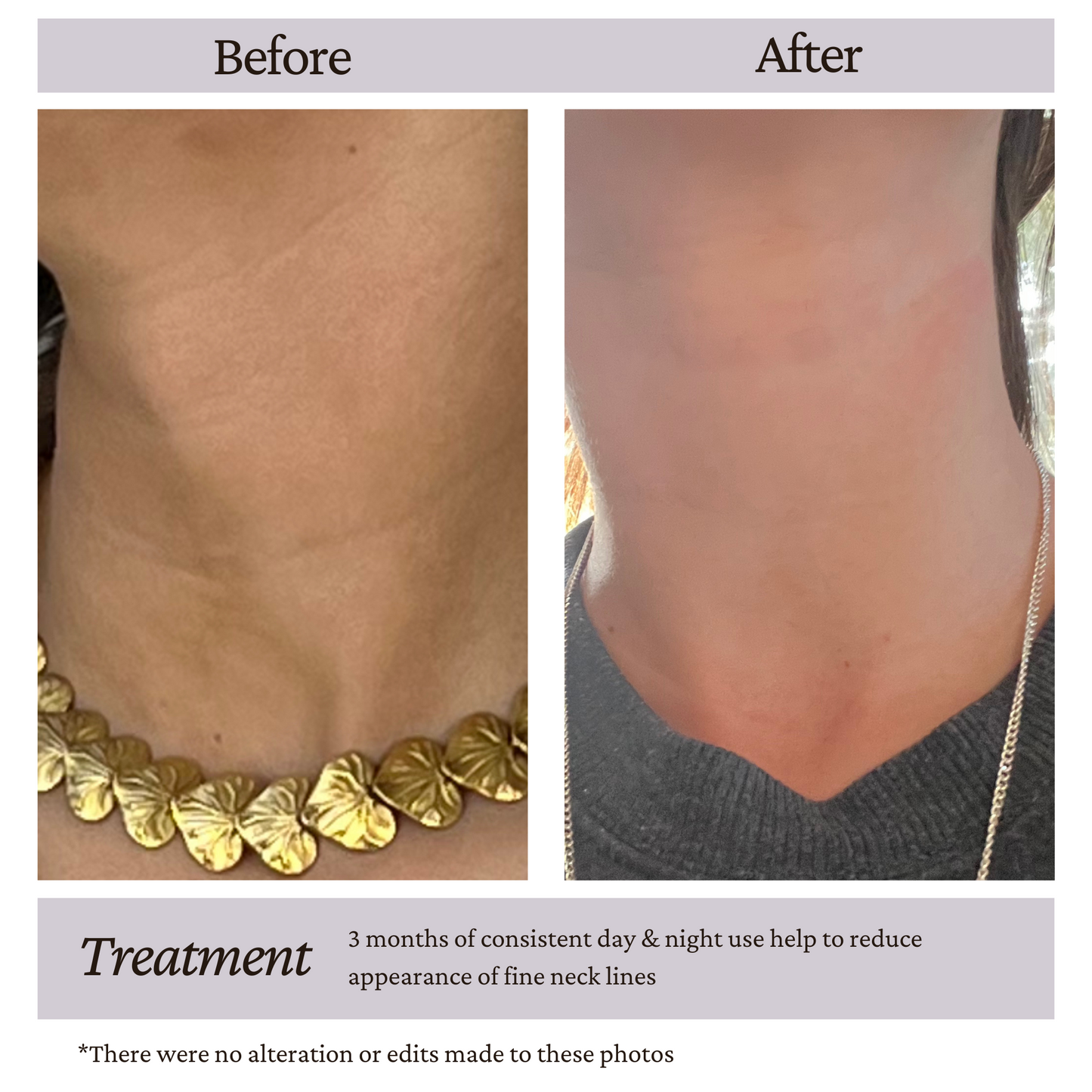 retinol alternative before and after