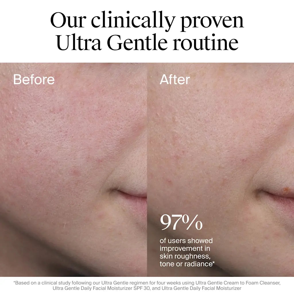 Neutrogena Fragrance Free Daily Facial Moisturizer, Face & Neck Moisturizer for Sensitive Skin with Vitamin B3, Pro-Vitamin B5 & Vitamin E Supports Skin's Dynamic Barrier, 3.4 fl. oz