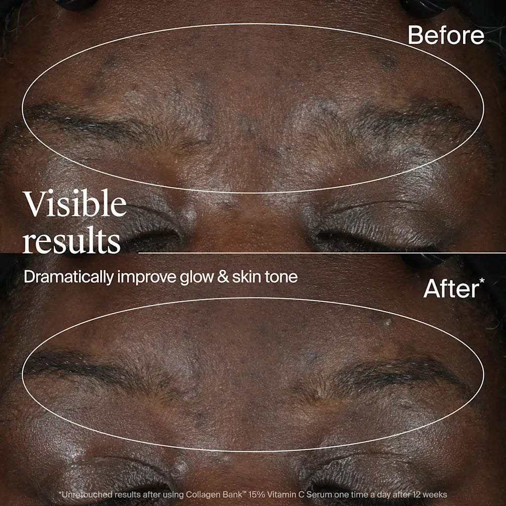 Neutrogena Collagen Bank 15% Vitamin C Face Serum, Vitamin C Serum for Face Helps Build Collagen for Glowing, Plumper Looking Skin, Uneven Skin Tone Treatment, Fragrance Free, 0.5 fl. oz