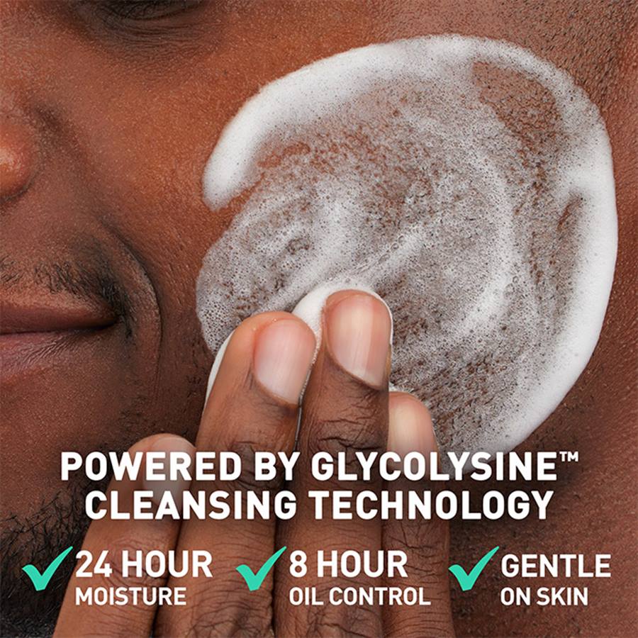 CeraVe Acne Foaming Cream Cleanser, 4% Benzoyl Peroxide Face Wash With Hyaluronic Acid, Niacinamide & Ceramides, Gentle Daily Acne Treatment For Face